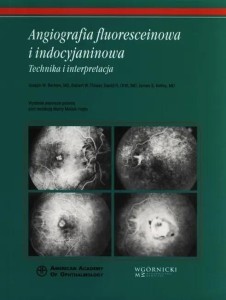 ANGIOGRAFIA FLUORESCEINOWA I INDOCYJANINOWA