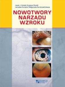NOWOTWORY NARZĄDU WZROKU, PRACA ZBIOROWA