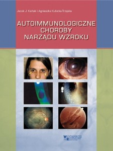 AUTOIMMUNOLOGICZNE CHOROBY NARZĄDU WZROKU