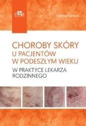 Choroby skóry u pacjentów w podeszłym wieku