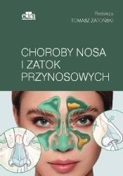 CHOROBY NOSA I ZATOK PRZYNOSOWYCH, TOMASZ ZATOŃSKI