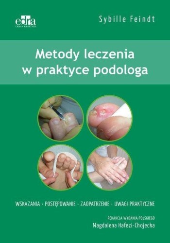Metody leczenia w podologii, Sybille Feindt