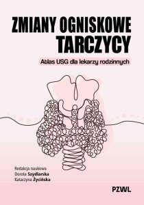ZMIANY OGNISKOWE TARCZYCY. ATLAS USG DLA LEKARZY..