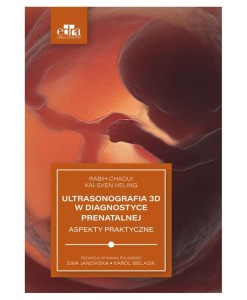 ULTRASONOGRAFIA 3D W DIAGNOSTYCE PRENATALNEJ