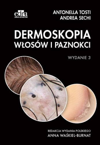 Dermoskopia włosów i paznokci, A. Sechi, A. Tosti