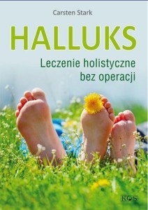 HALLUKS. LECZENIE HOLISTYCZNE BEZ OPERACJI