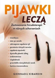 PIJAWKI LECZĄ. ZASTOSOWANIE HIRUDOTERAPII...