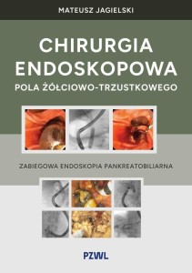 CHIRURGIA ENDOSKOPOWA POLA ŻÓŁCIOWO-TRZUSTKOWEGO